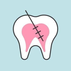 painless root canals in Rockville, Maryland