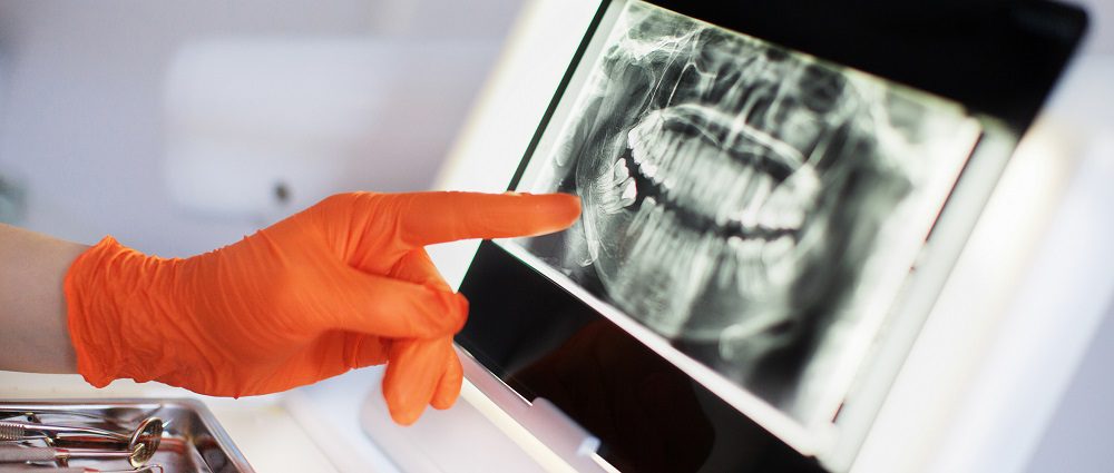 preventative care with dental x-rays