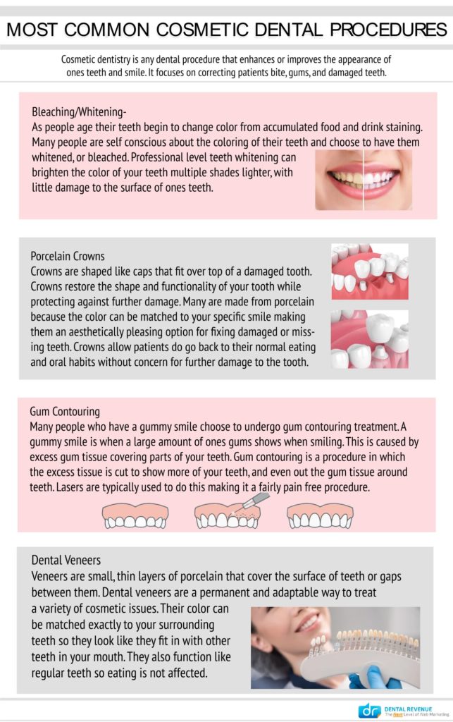 The most common cosmetic dental procedures